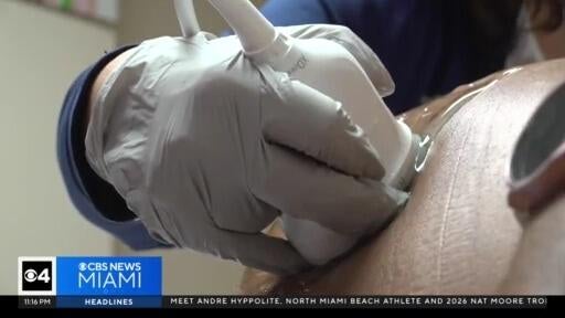Birth rate for women over the age of 35, or mature pregnancies, is rising — CBS Miami, Weston Health news