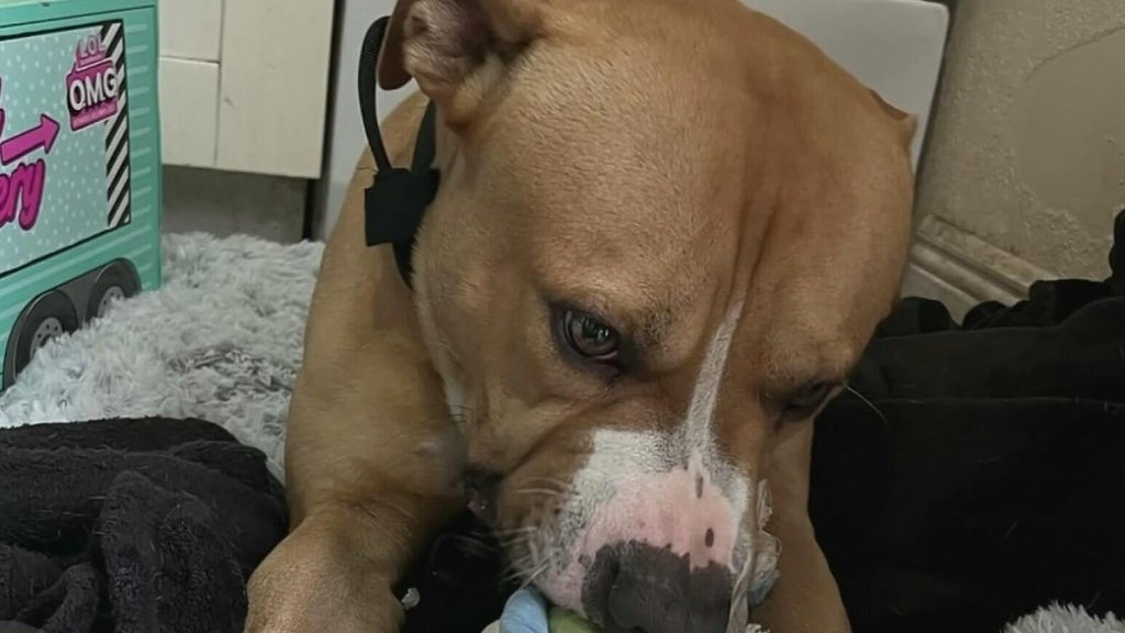 Teen girl remains hospitalized after dog attack in northwest Miami-Dade; owner surrenders pit bull — CBS Miami, Weston Health news